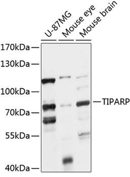 Western blot - TIPARP antibody (A14329)