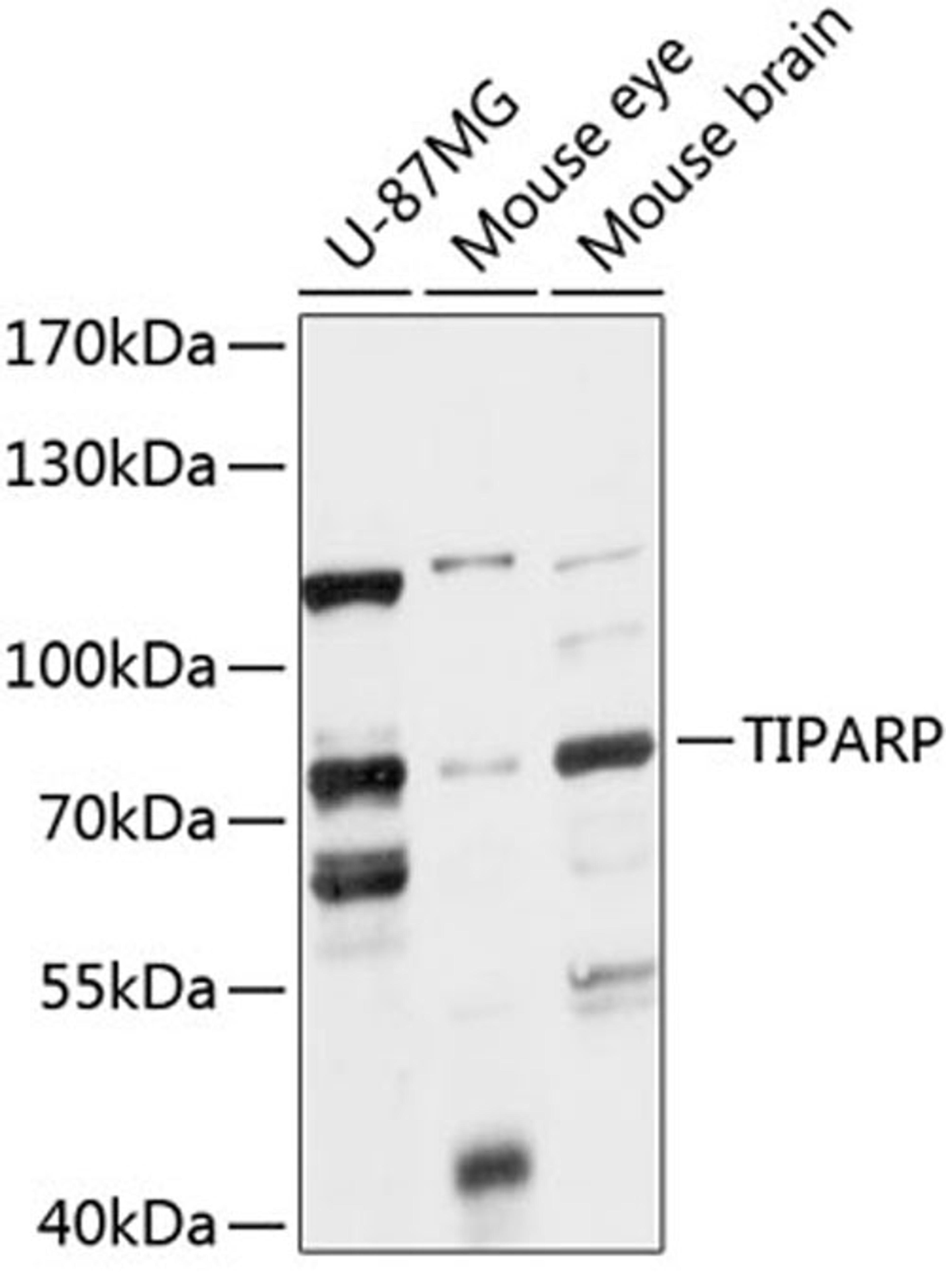 Western blot - TIPARP antibody (A14329)