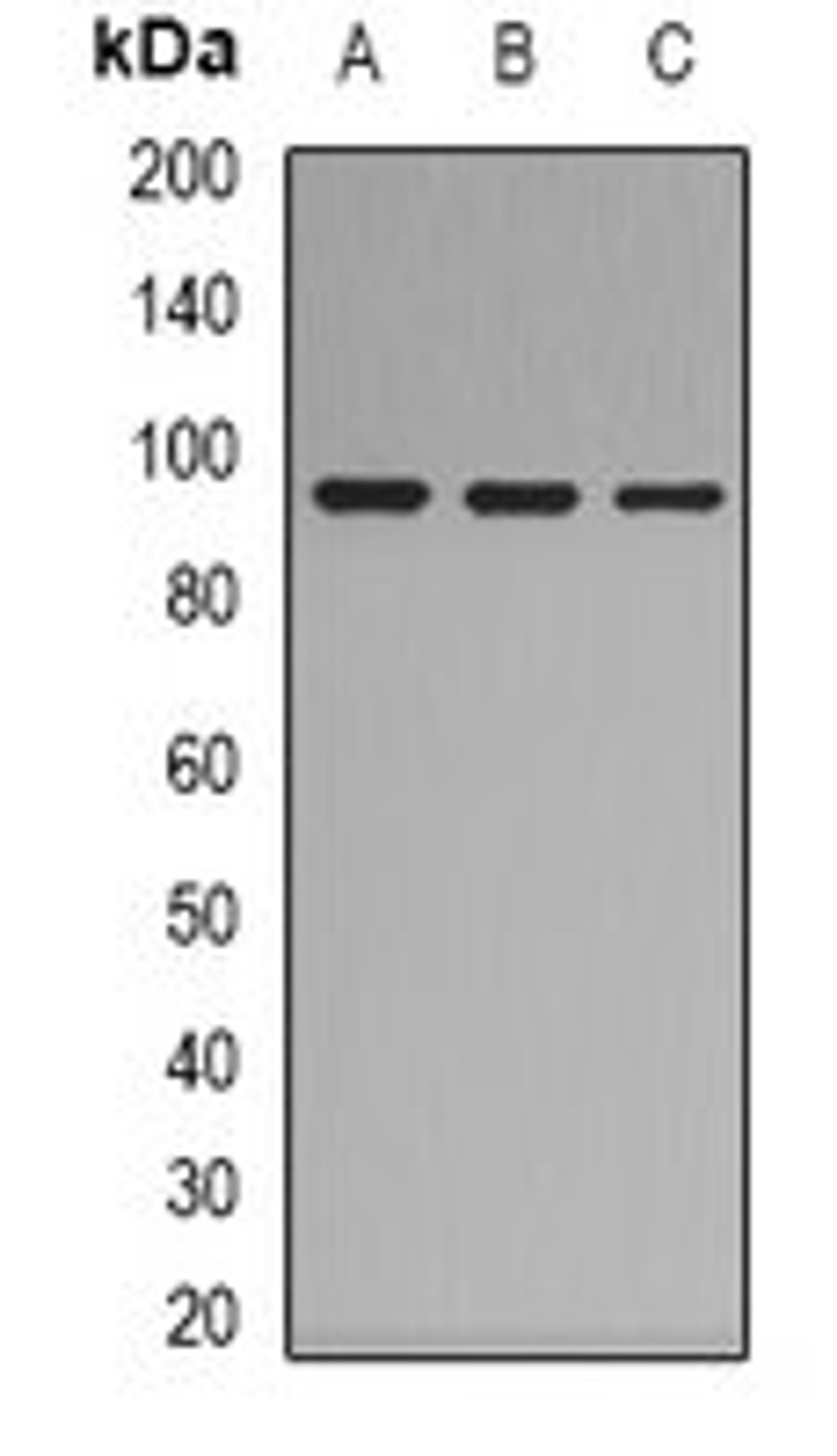 Western blot analysis of HepG2 (Lane 1), K562 (Lane 2), mouse lung (Lane 3) whole cell lysates using Complement C7 antibody