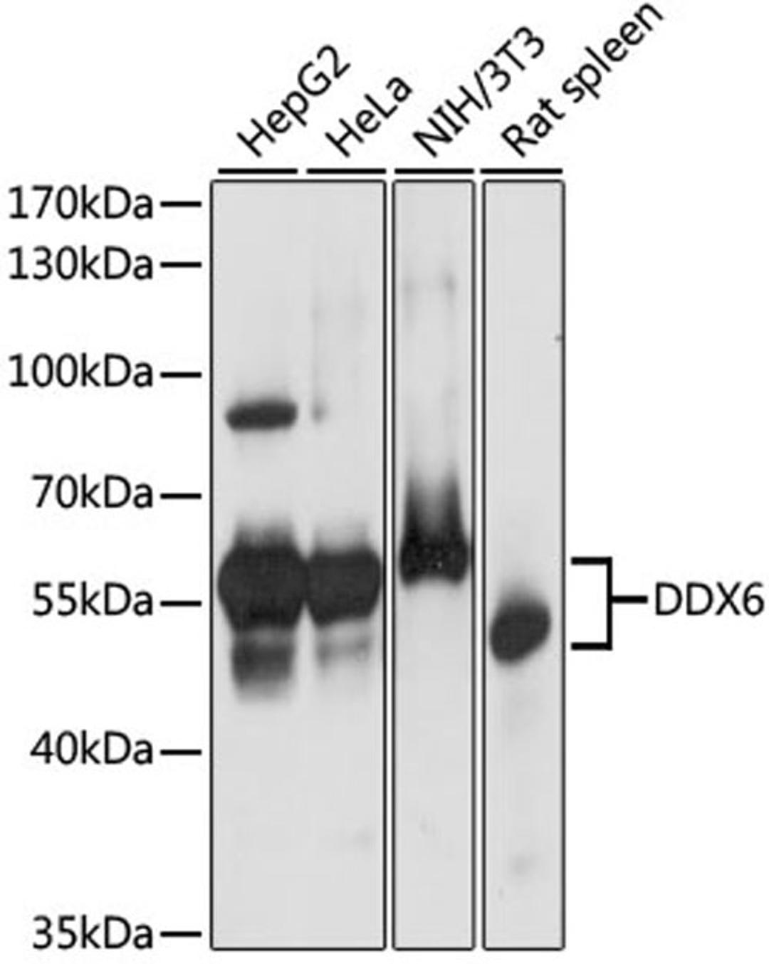 Western blot - DDX6 antibody (A16270)