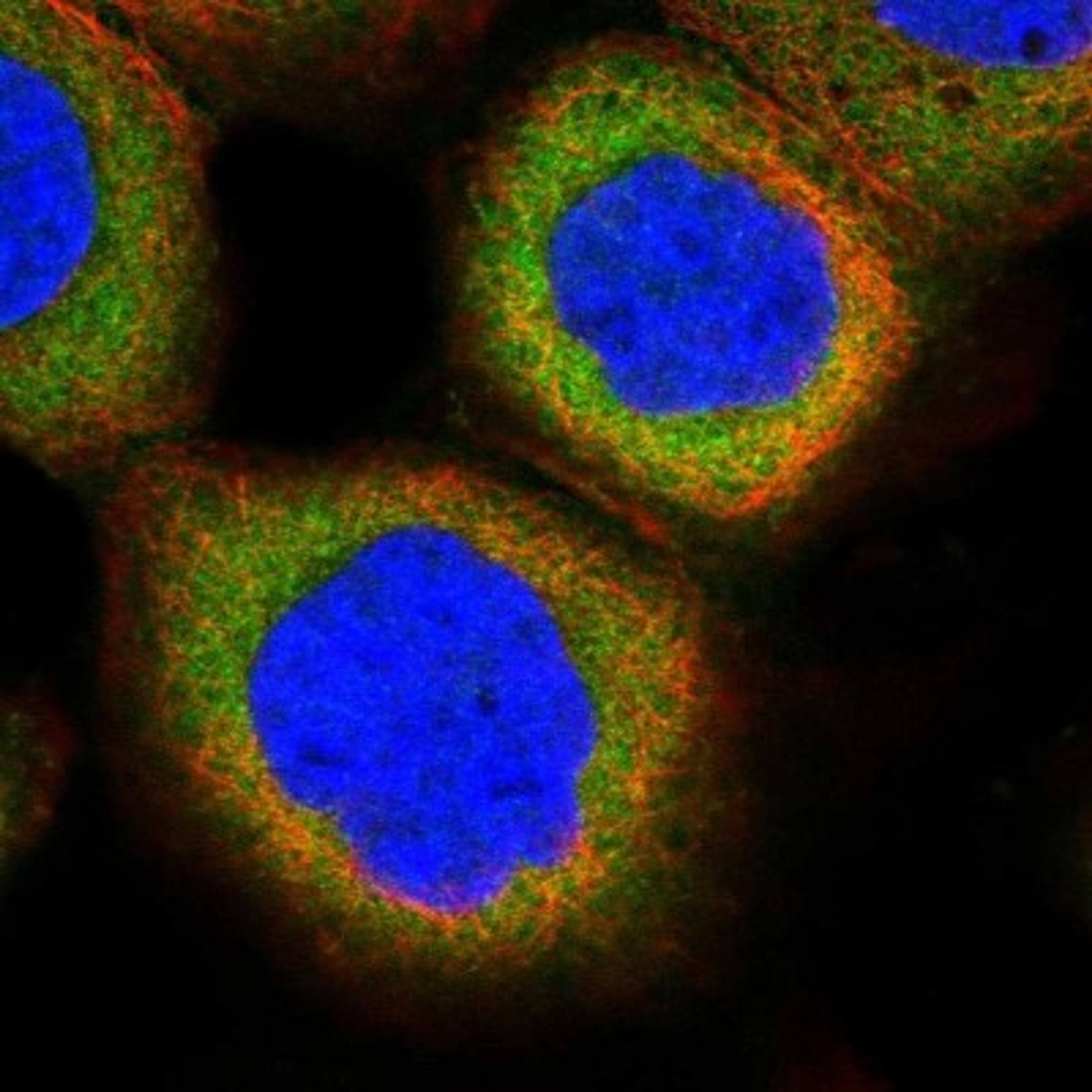 Immunocytochemistry/Immunofluorescence: PPP2R5D Antibody [NBP1-88959] - Staining of human cell line A-431 shows positivity in cytoplasm.