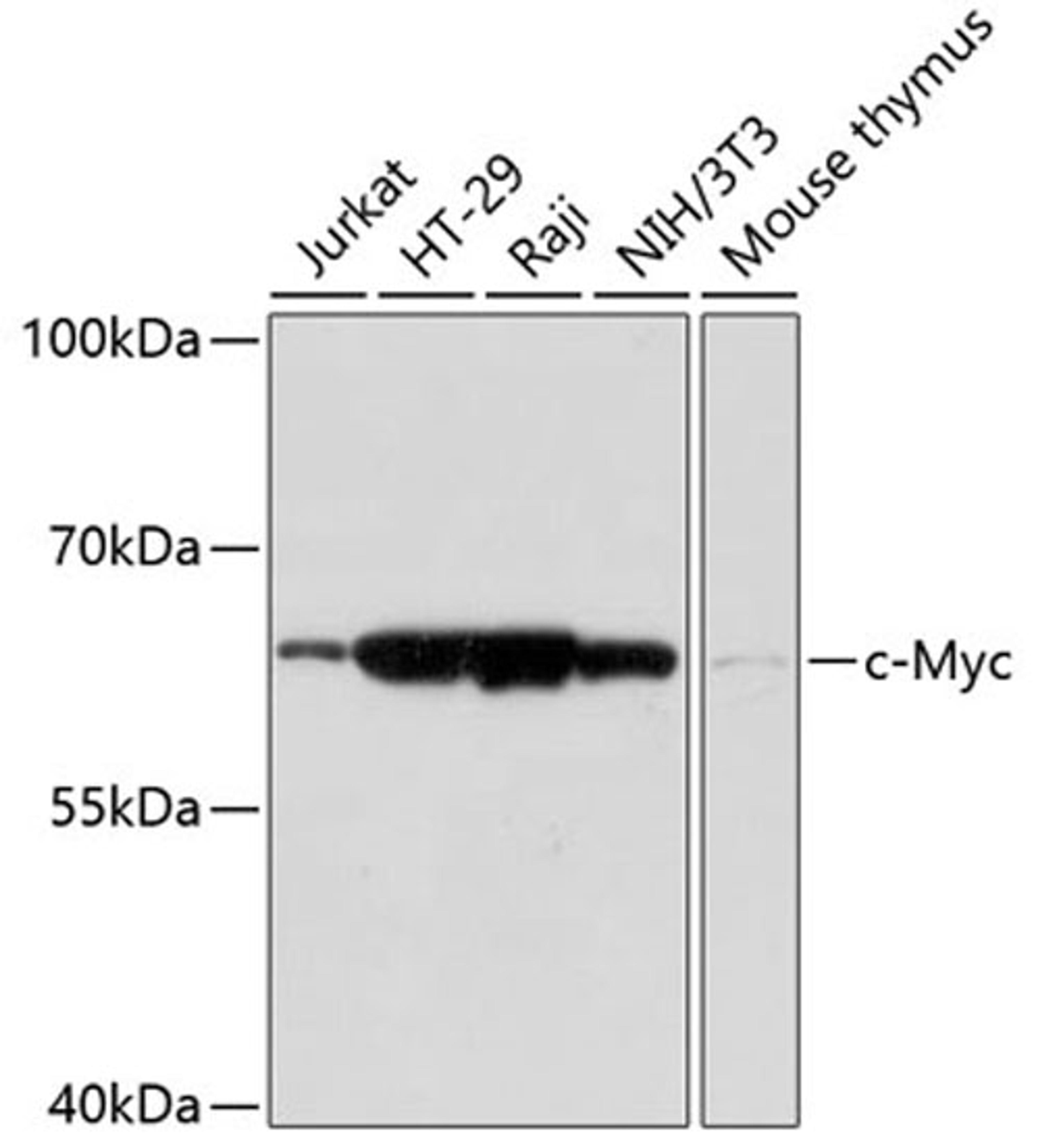 Western blot - c-Myc antibody (A17332)