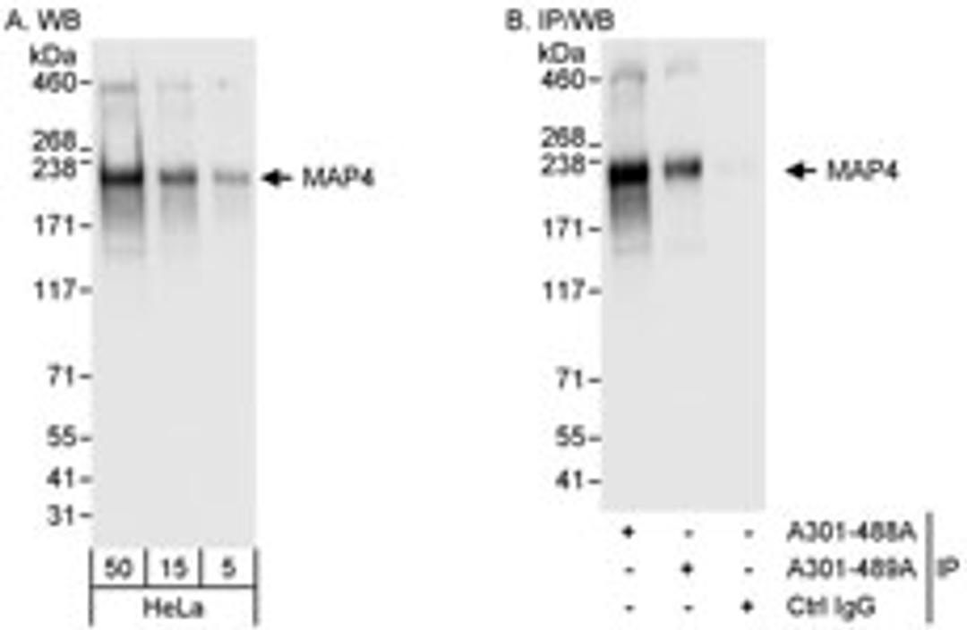 Detection of human MAP4 by western blot and immunoprecipitation.