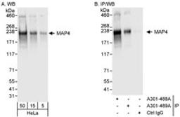 Detection of human MAP4 by western blot and immunoprecipitation.