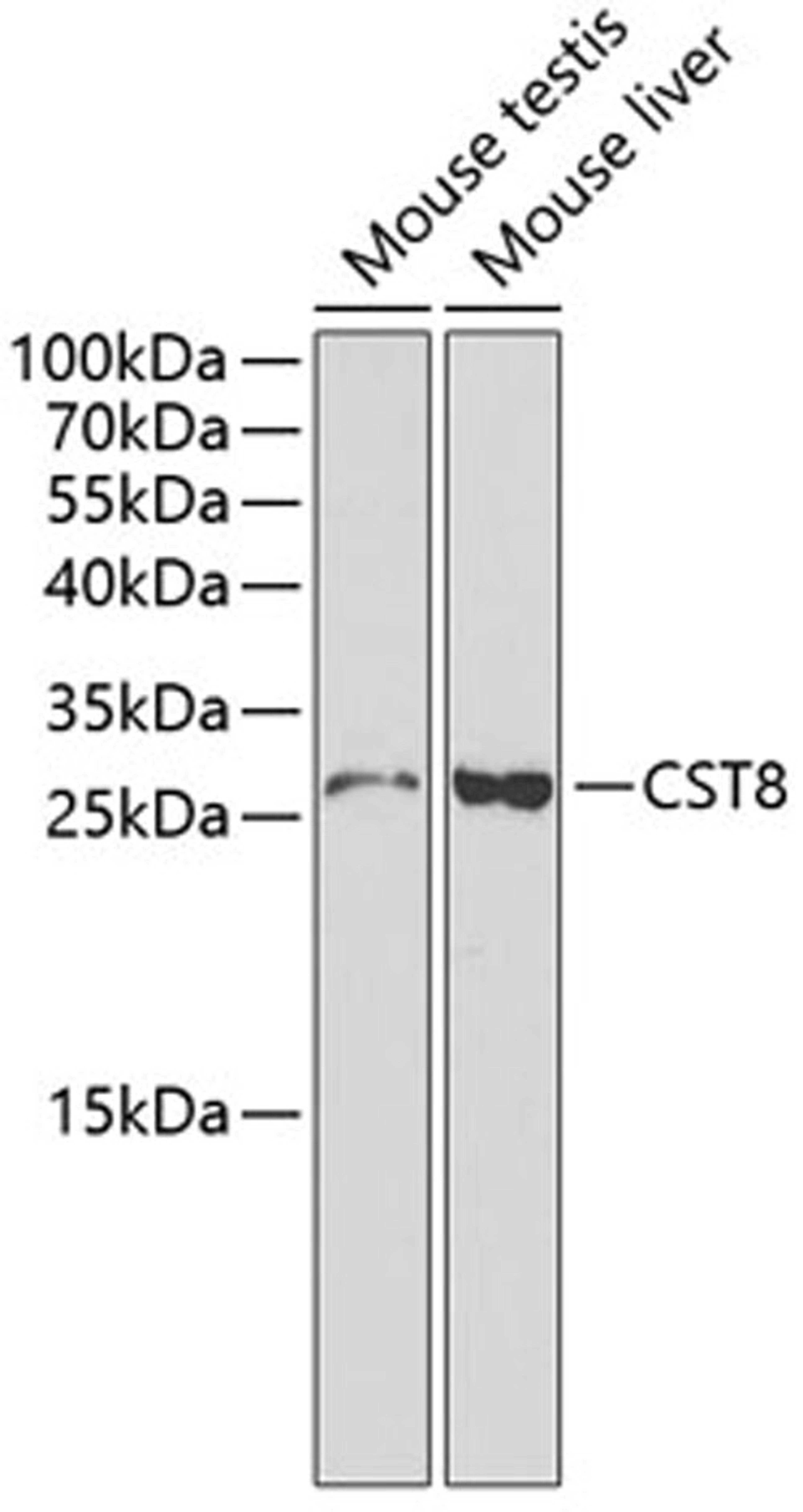 Western blot - CST8 antibody (A1224)