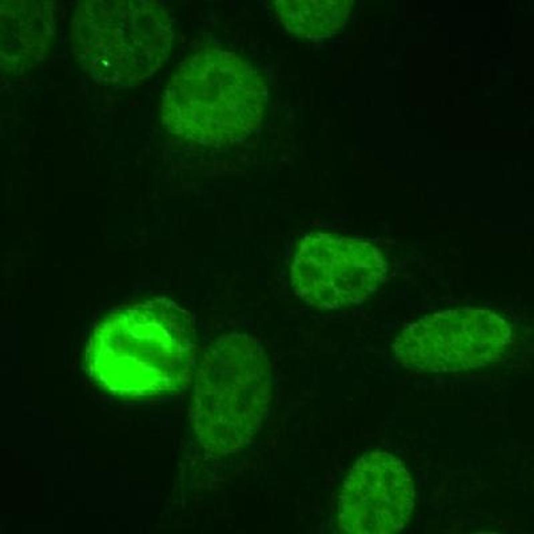 Immunocytochemistry/Immunofluorescence: NuMA Antibody [NB500-174] - Immunofluorescent image of human HeLa cells fixed with 3.5% formaldehyde and stained with NB500-174 at 1:1000 dilution. The staining pattern shows the typical pattern for NuMA in the cell nucleus during interphase and on spindles during mitosis.