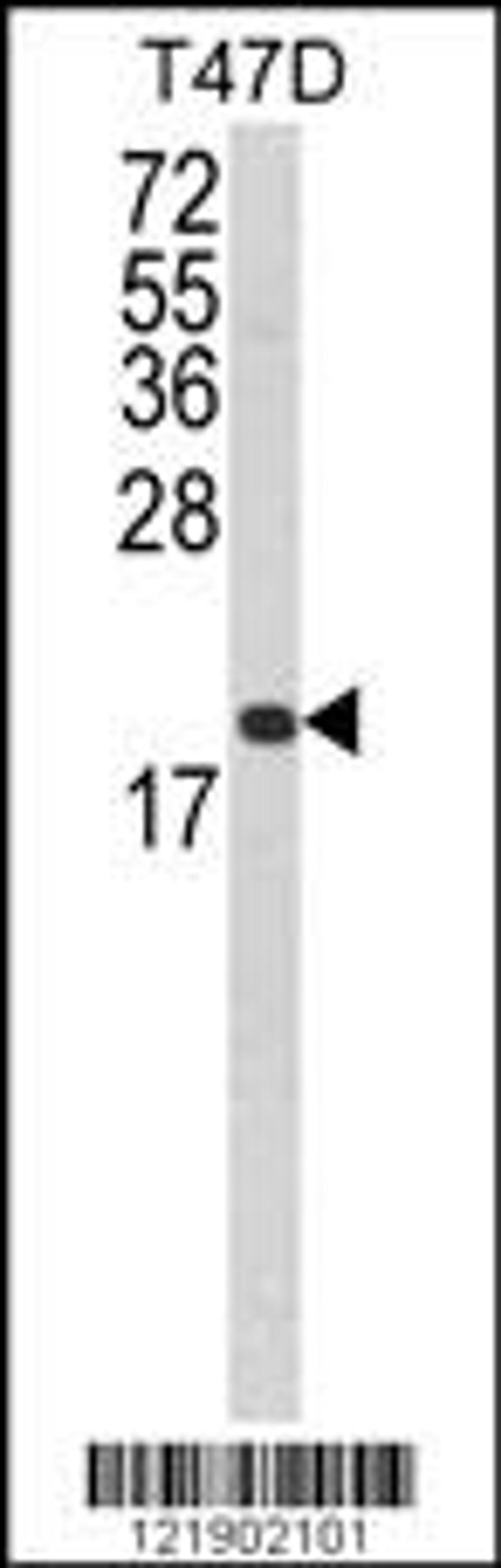 Western blot analysis of FAS Antibody in T47D cell line lysates (35ug/lane)