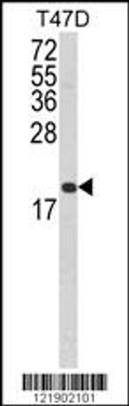 Western blot analysis of FAS Antibody in T47D cell line lysates (35ug/lane)