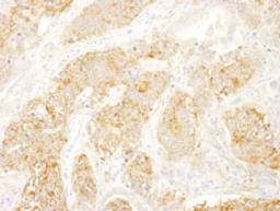 Detection of mouse eIF3B/EIF3S9 by immunohistochemistry.