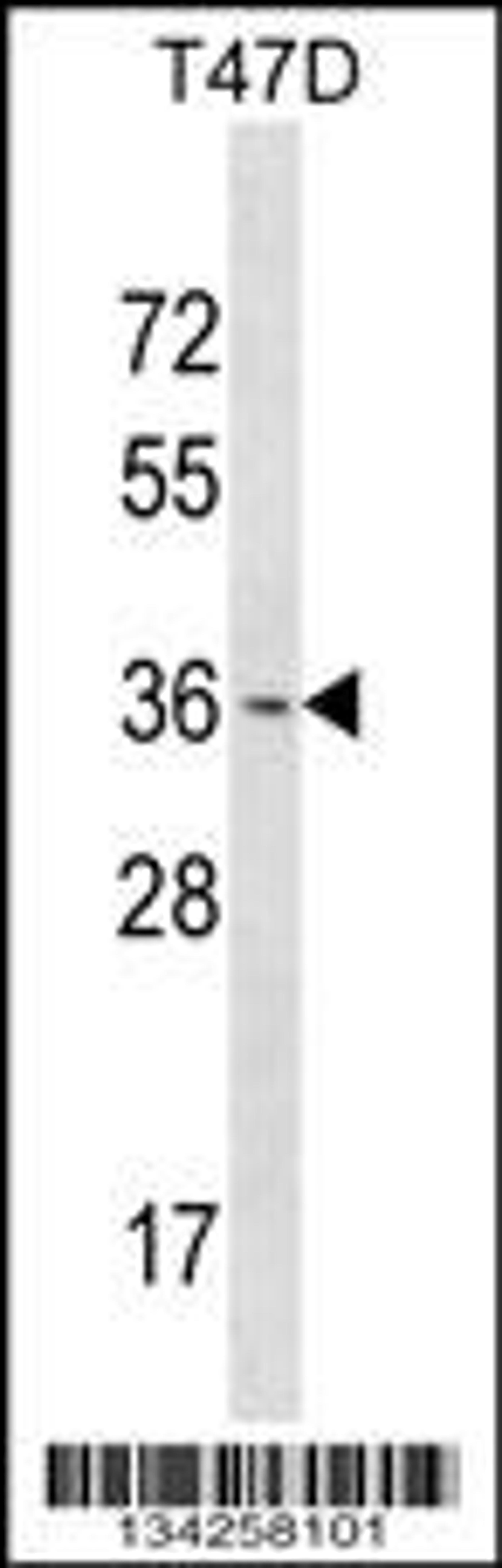 Western blot analysis in T47D cell line lysates (35ug/lane).