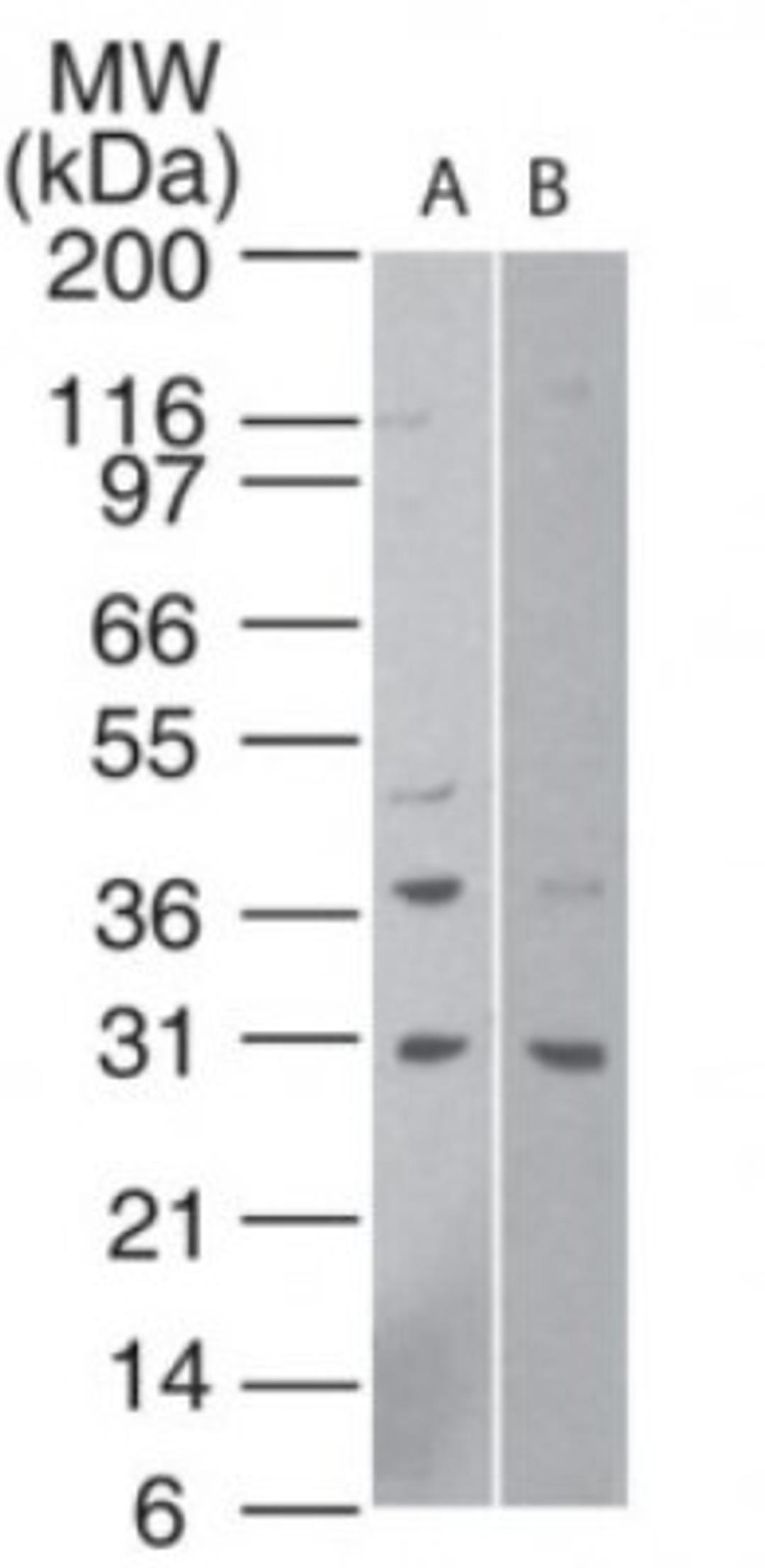 Western Blot: htrA1 Antibody [NBP2-23869] - Analysis of HtrA1 in human A) HeLa cell lysate (1 minute exposure) and B) human 293 cell lysate (15 minute exposure) using NBP2-23869 at 1:500.