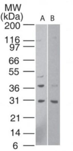 Western Blot: htrA1 Antibody [NBP2-23869] - Analysis of HtrA1 in human A) HeLa cell lysate (1 minute exposure) and B) human 293 cell lysate (15 minute exposure) using NBP2-23869 at 1:500.