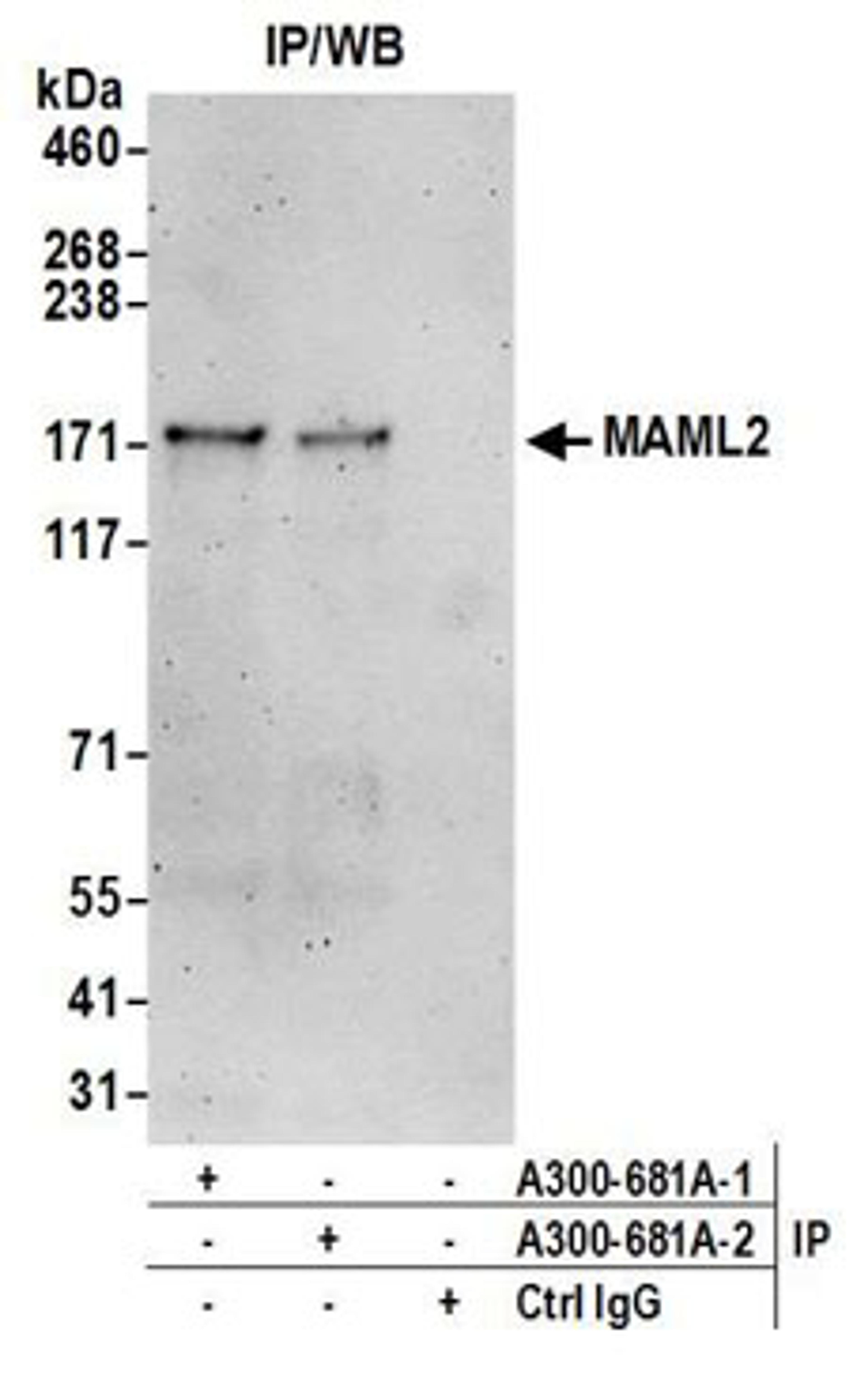 Detection of human MAML2 by western blot of immunoprecipitates.