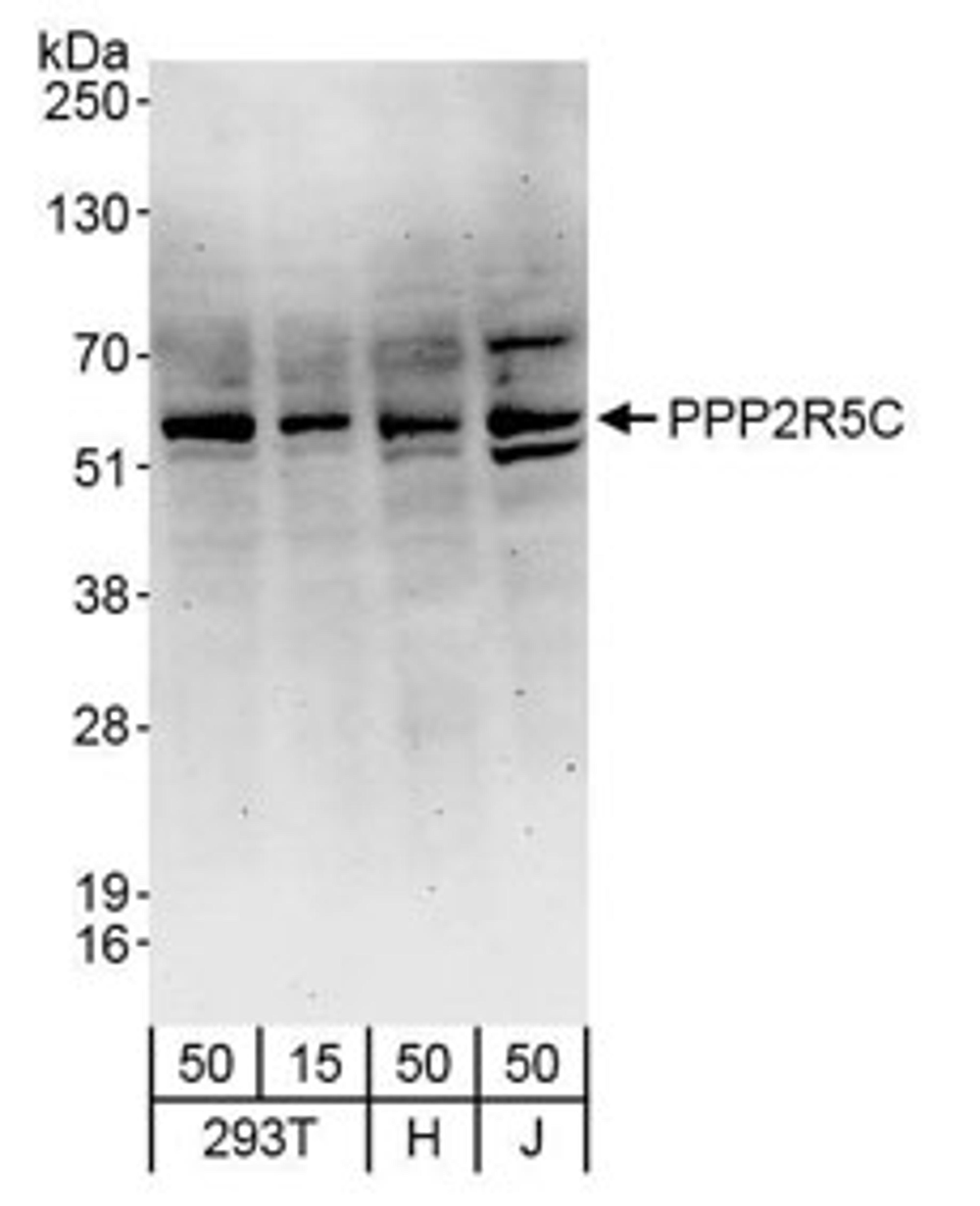 Detection of human PPP2R5C by western blot.