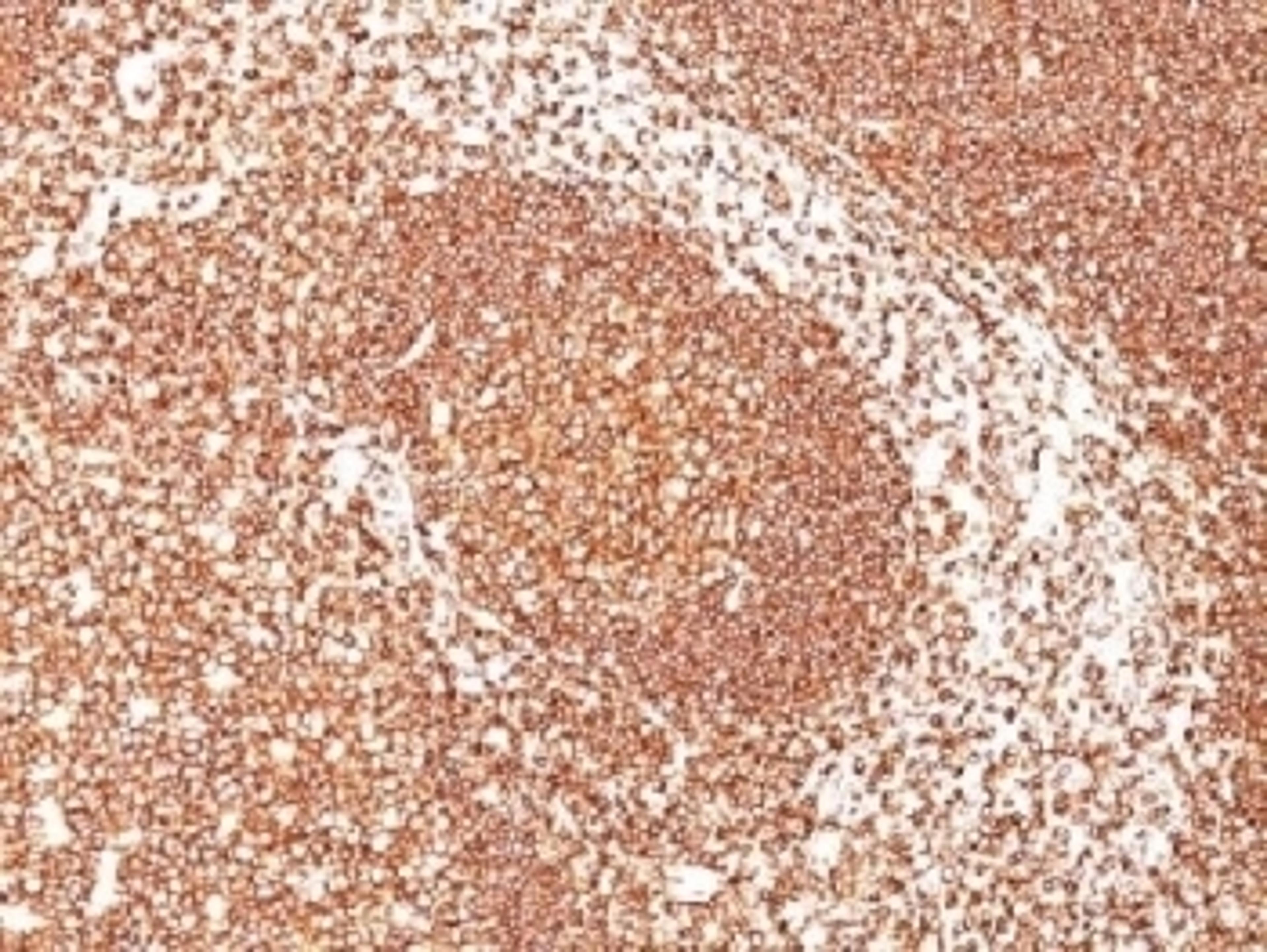 IHC test of FFPE human tonsil probed with CD45 antibody (clone PTPRC/1461). Required HIER: boil tissue sections in 10mM citrate buffer, pH 6, for 10-20 min.