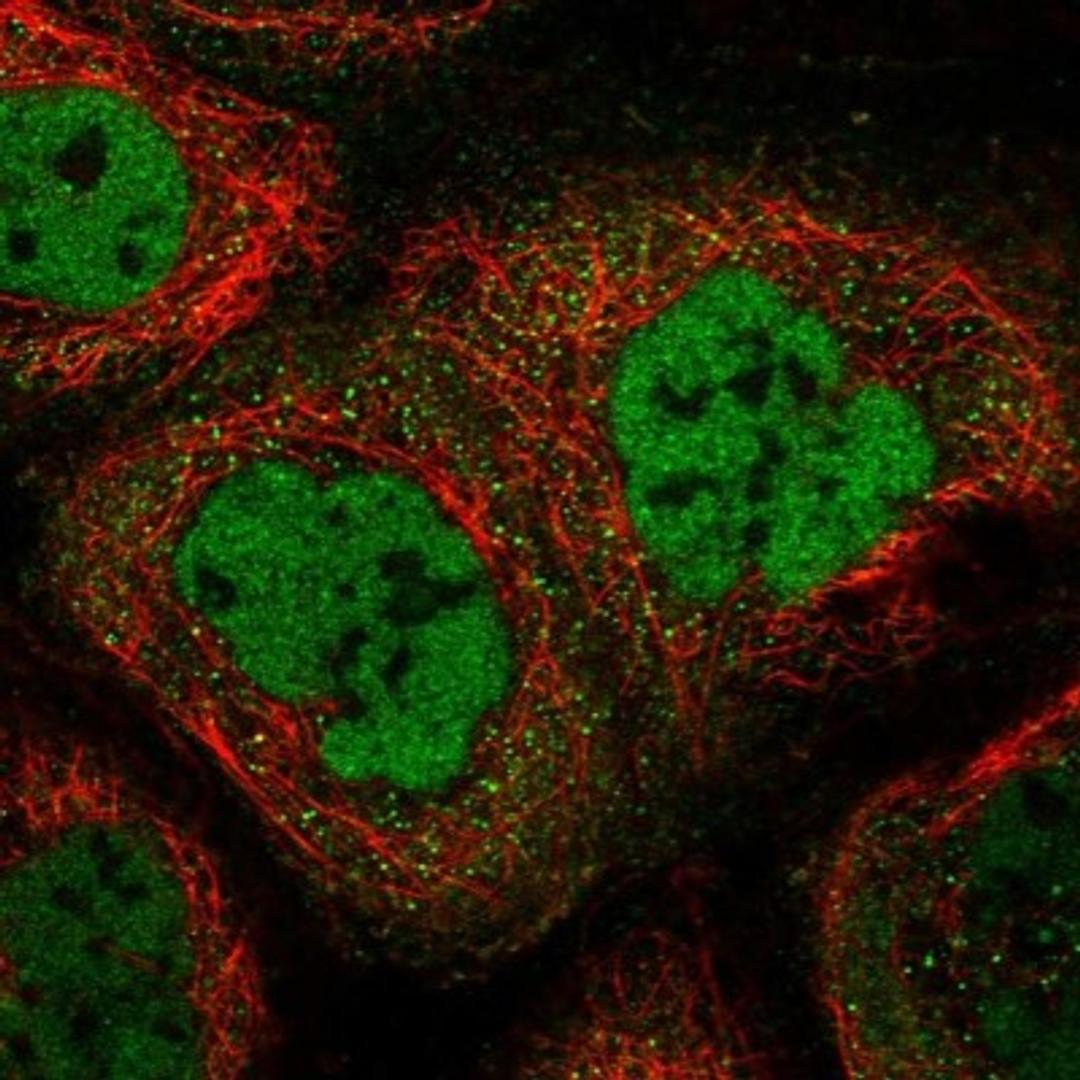 Immunocytochemistry/Immunofluorescence: ZC3H4 Antibody [NBP1-88475] - Staining of human cell line A-431 shows positivity in nucleus but not nucleoli & cytoplasm.