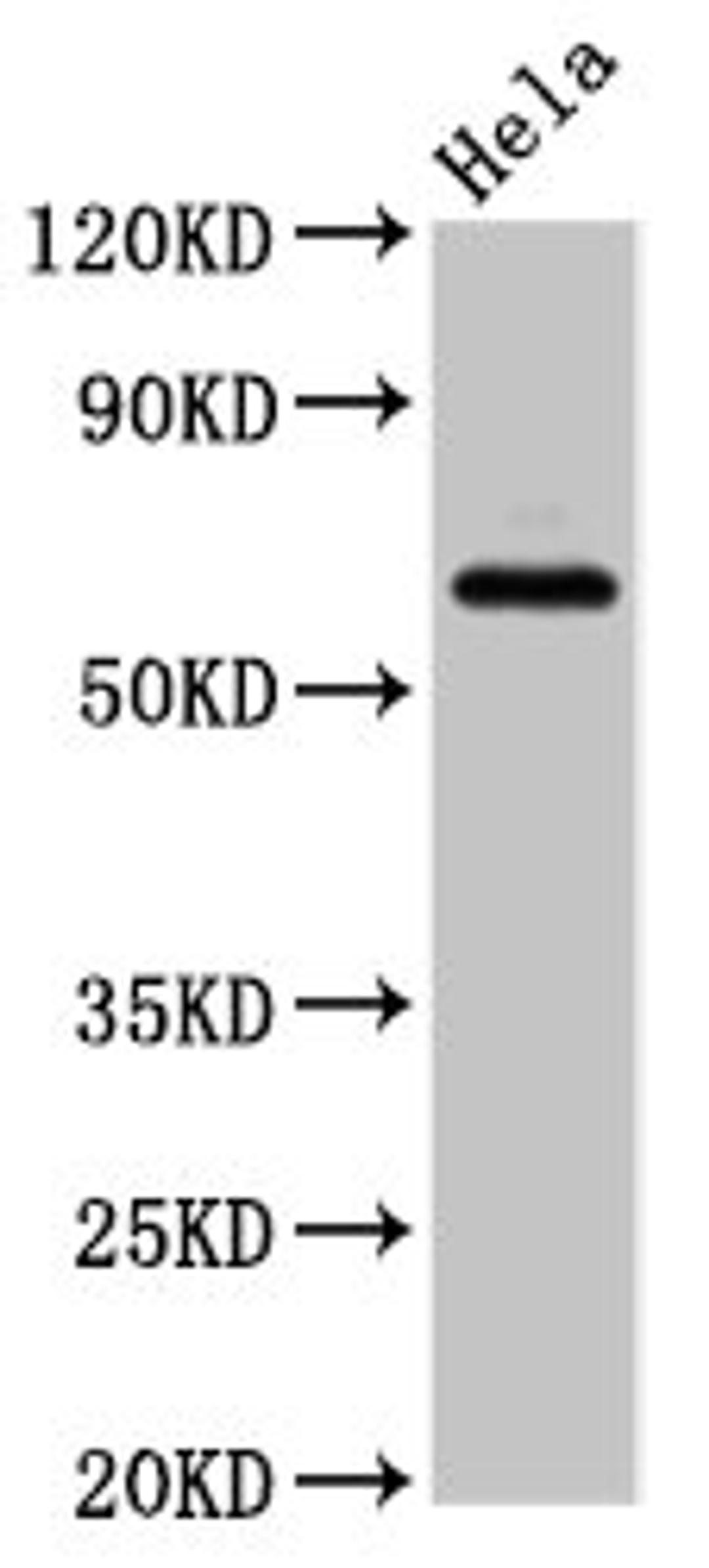 Western Blot. Positive WB detected in: Hela whole cell lysate. All lanes: SLC22A25 antibody at 6.8ug/ml. Secondary. Goat polyclonal to rabbit IgG at 1/50000 dilution. Predicted band size: 62 kDa. Observed band size: 62 kDa. 