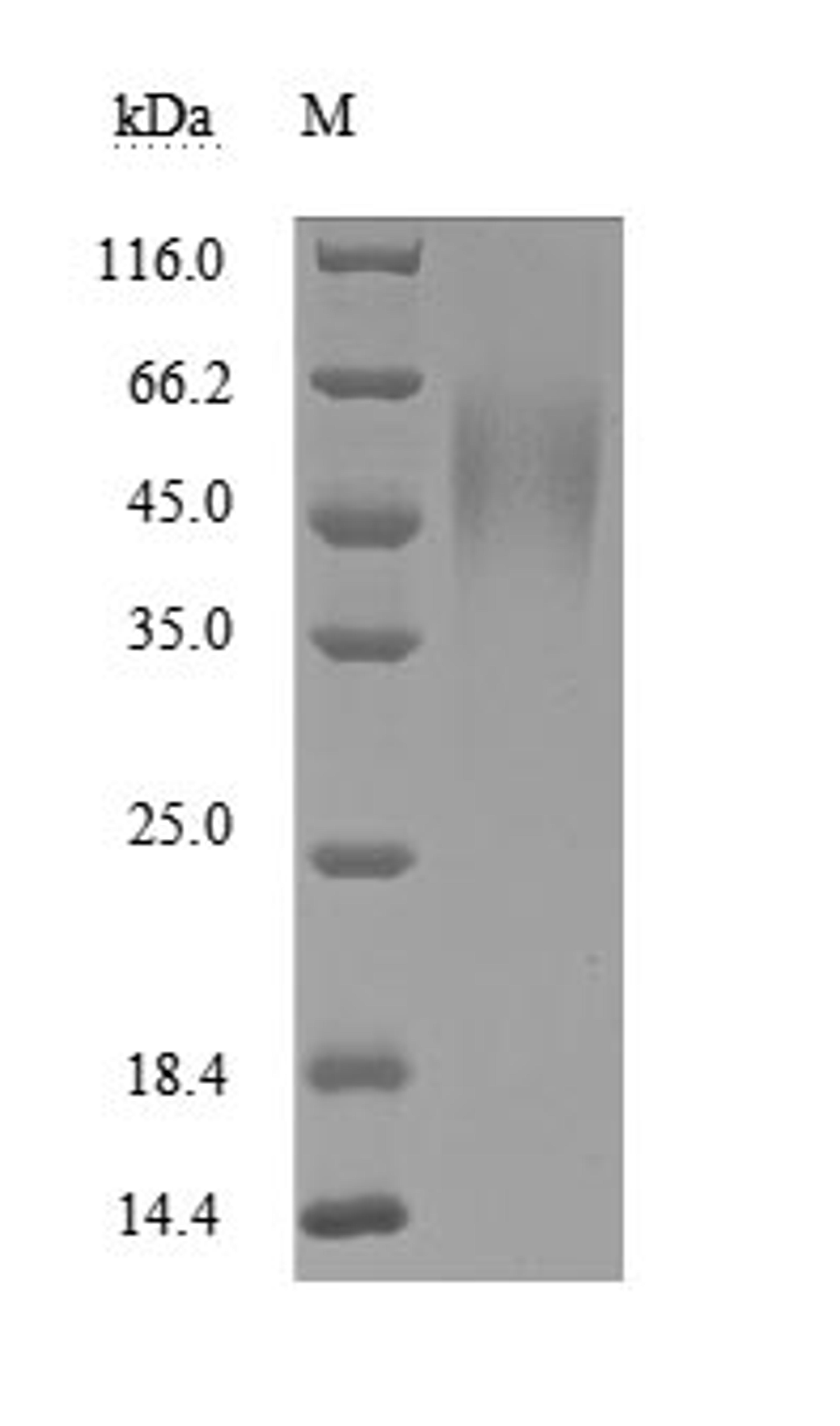 (Tris-Glycine gel) Discontinuous SDS-PAGE (reduced) with 5% enrichment gel and 15% separation gel.