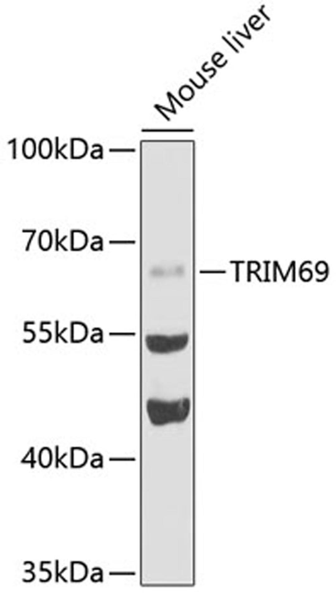 Western blot - TRIM69 antibody (A5910)