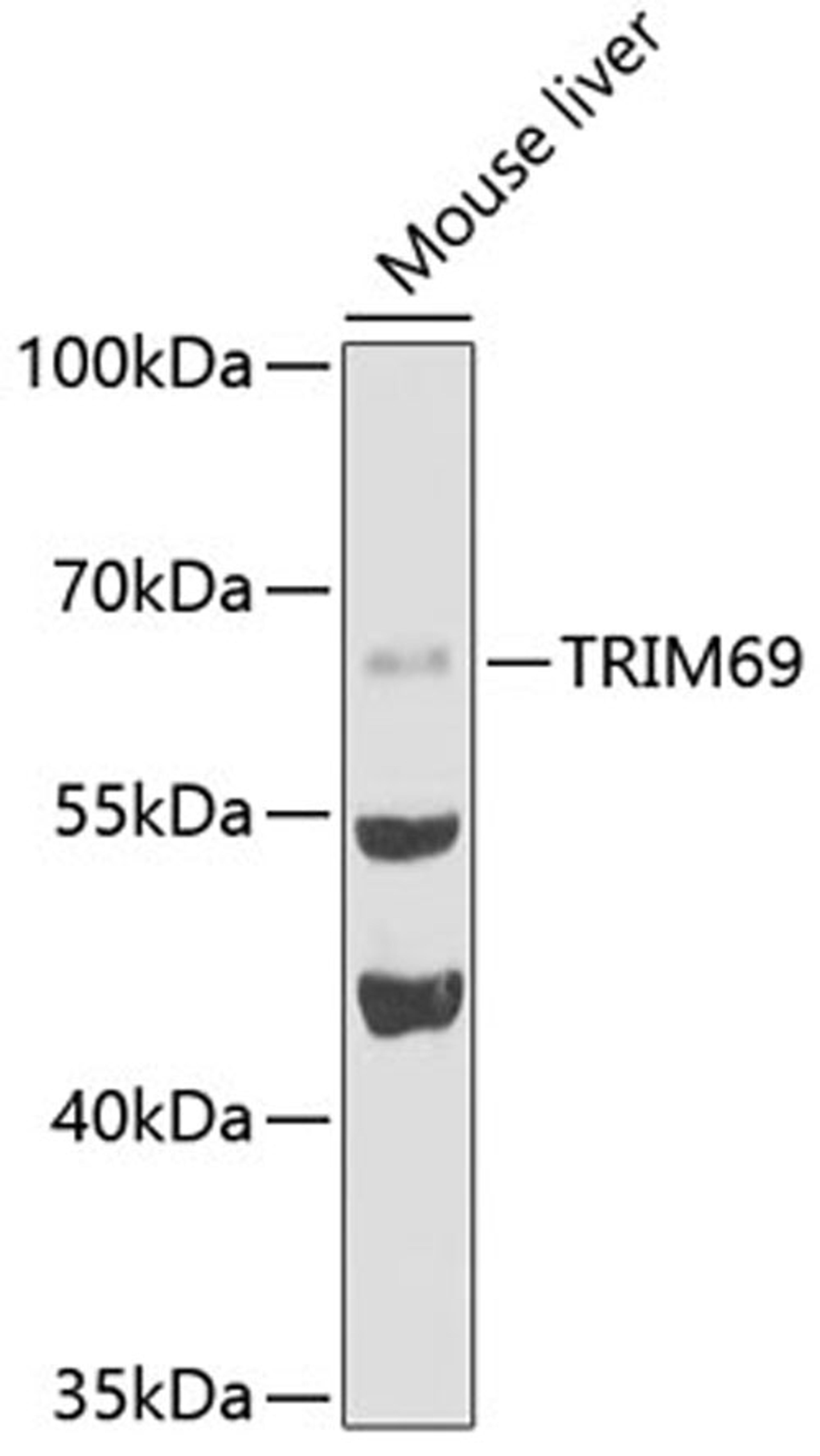 Western blot - TRIM69 antibody (A5910)