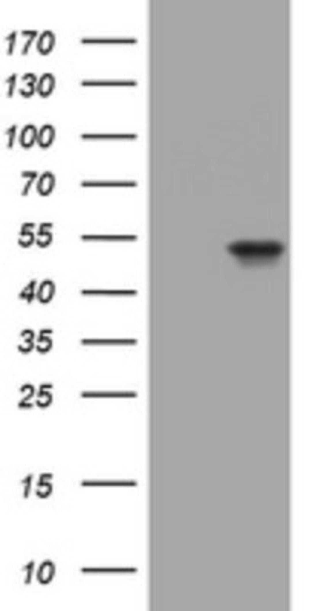 Western Blot: Cytokeratin 20 Antibody (3G1) [NBP2-45556] - Analysis of HEK293T cells were transfected with the pCMV6-ENTRY control (Left lane) or pCMV6-ENTRY Cytokeratin 20.