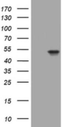 Western Blot: Cytokeratin 20 Antibody (3G1) [NBP2-45556] - Analysis of HEK293T cells were transfected with the pCMV6-ENTRY control (Left lane) or pCMV6-ENTRY Cytokeratin 20.