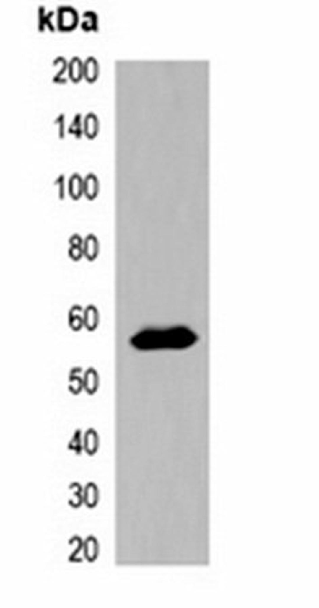 Western blot analysis of 293T cell lysate using MBP-tag antibody