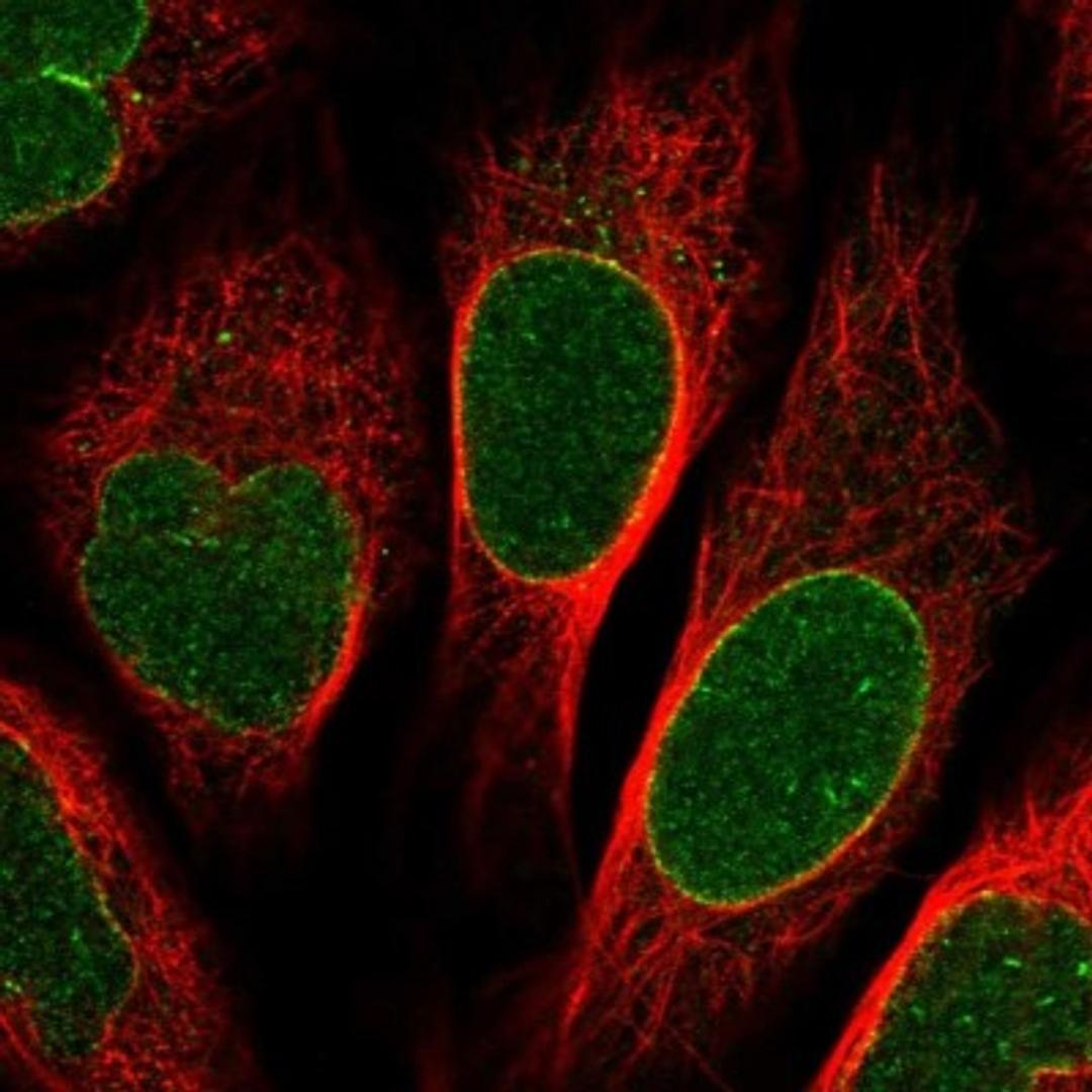 Immunocytochemistry/Immunofluorescence: NUP155 Antibody [NBP1-82960] - Staining of human cell line U-2 OS shows positivity in nuclear membrane.