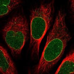 Immunocytochemistry/Immunofluorescence: NUP155 Antibody [NBP1-82960] - Staining of human cell line U-2 OS shows positivity in nuclear membrane.