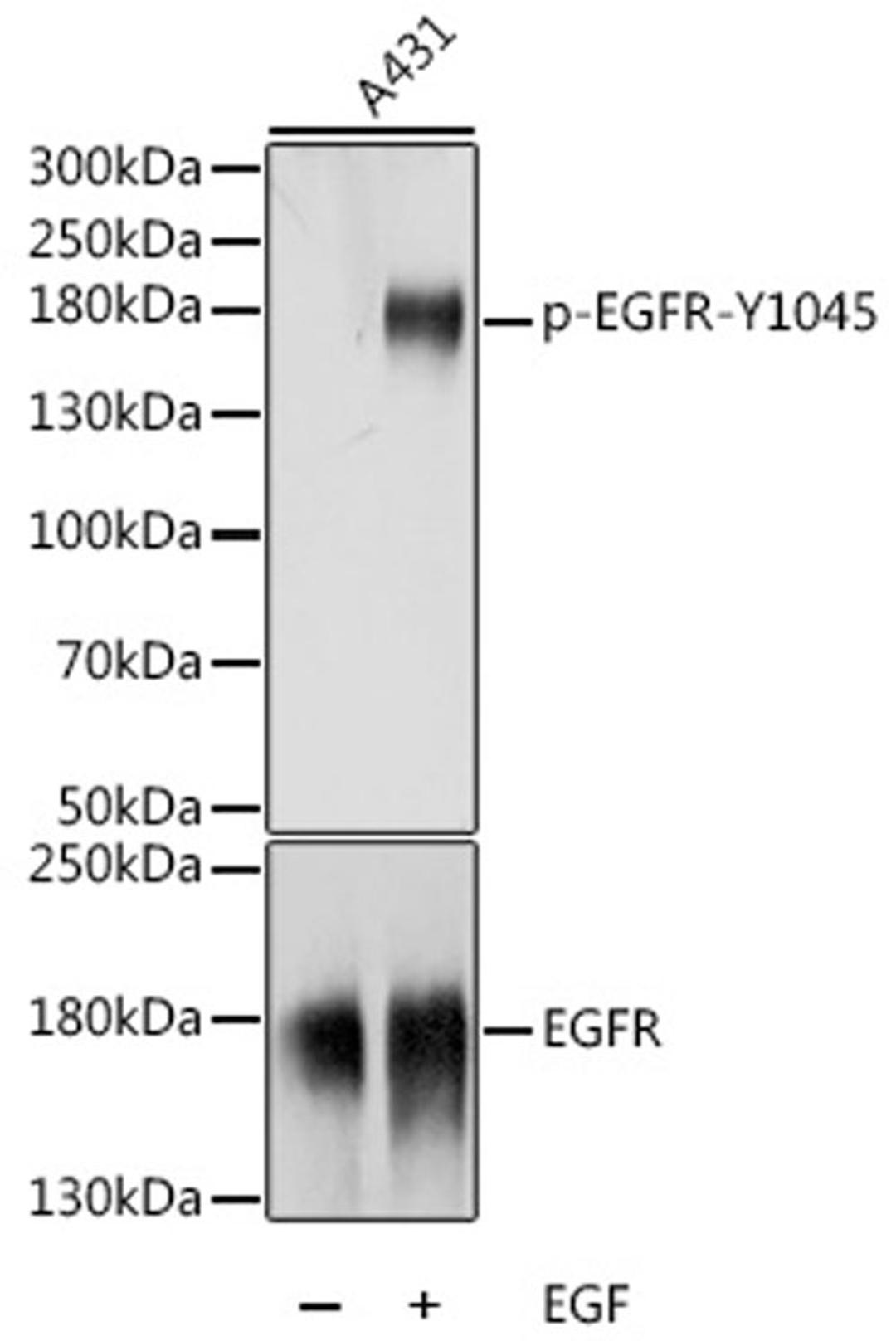 Western blot - Phospho-EGFR-Y1045 antibody (AP0819)