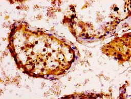 IHC image of CSB-PA012696LA01HU diluted at 1:100 and staining in paraffin-embedded human testis tissue performed on a Leica BondTM system. After dewaxing and hydration, antigen retrieval was mediated by high pressure in a citrate buffer (pH 6.0). Section was blocked with 10% normal goat serum 30min at RT. Then primary antibody (1% BSA) was incubated at 4&deg;C overnight. The primary is detected by a biotinylated secondary antibody and visualized using an HRP conjugated SP system.