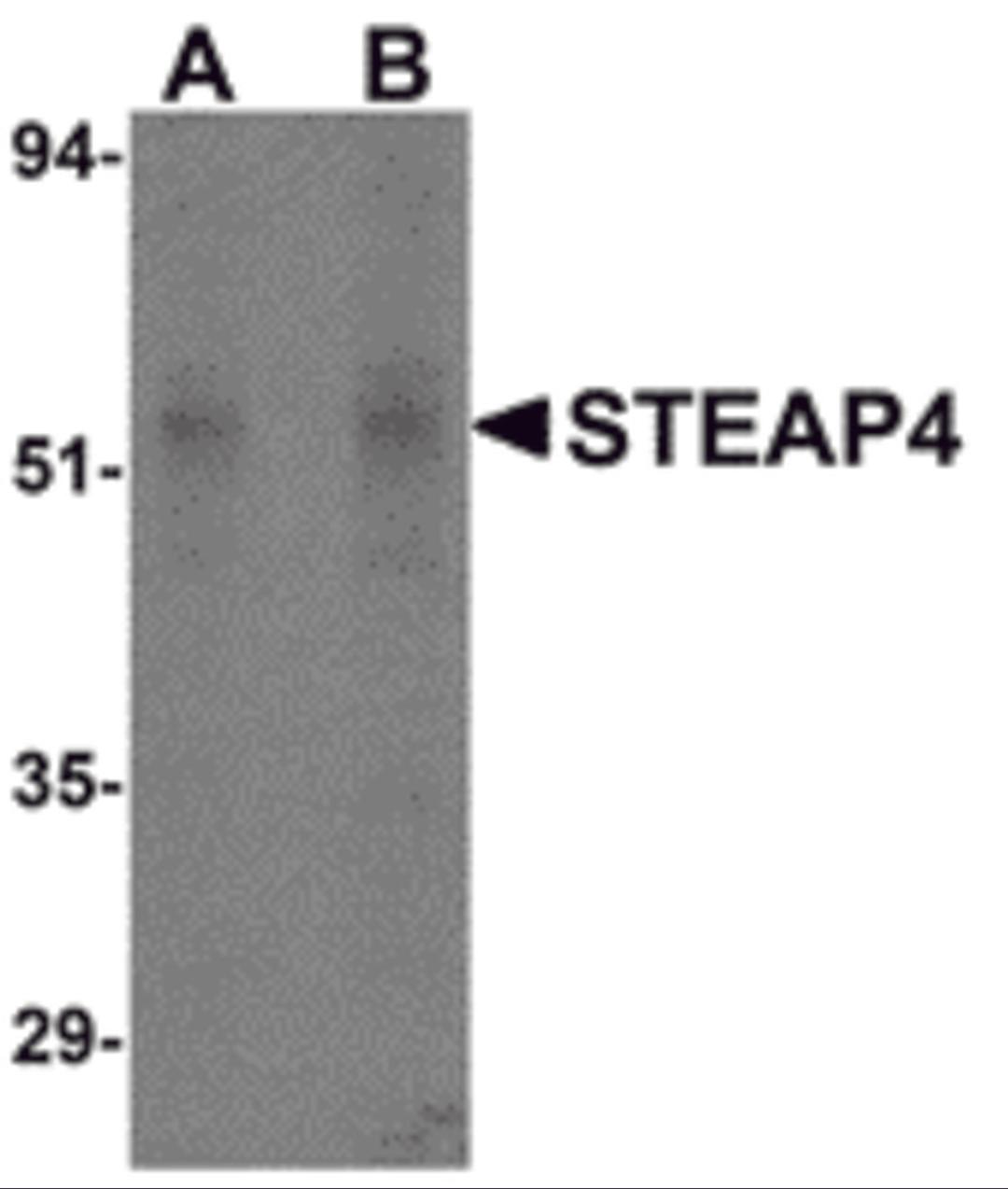 Western blot analysis of STEAP4 in rat liver tissue lysate with STEAP4 antibody at (A) 0.5 and (B) 1 μg/mL.