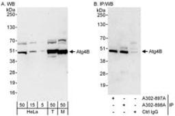 Detection of human and mouse Atg4B by western blot (h&m) and immunoprecipitation (h).