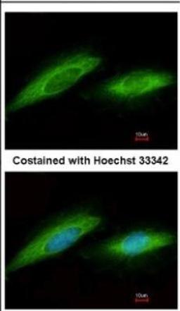 Immunocytochemistry/Immunofluorescence: GO Protein alpha Antibody [NBP2-16703] - Immunofluorescence analysis of methanol-fixed HeLa, using antibody at 1:200 dilution.