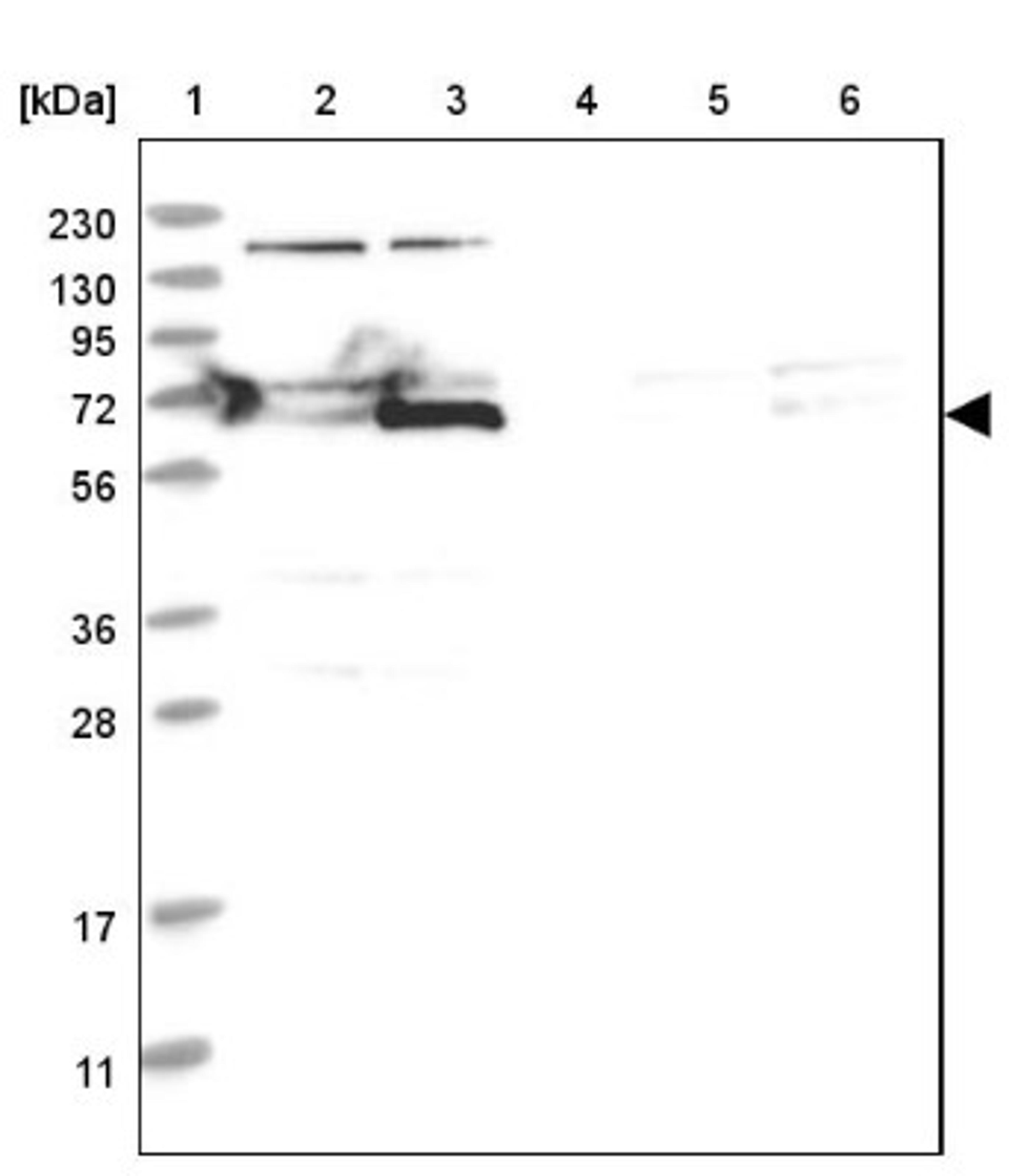 Western Blot: KIF2B Antibody [NBP1-86002] - Lane 1: Marker [kDa] 230, 130, 95, 72, 56, 36, 28, 17, 11<br/>Lane 2: Human cell line RT-4<br/>Lane 3: Human cell line U-251MG sp<br/>Lane 4: Human plasma (IgG/HSA depleted)<br/>Lane 5: Human liver tissue<br/>Lane 6: Human tonsil tissue