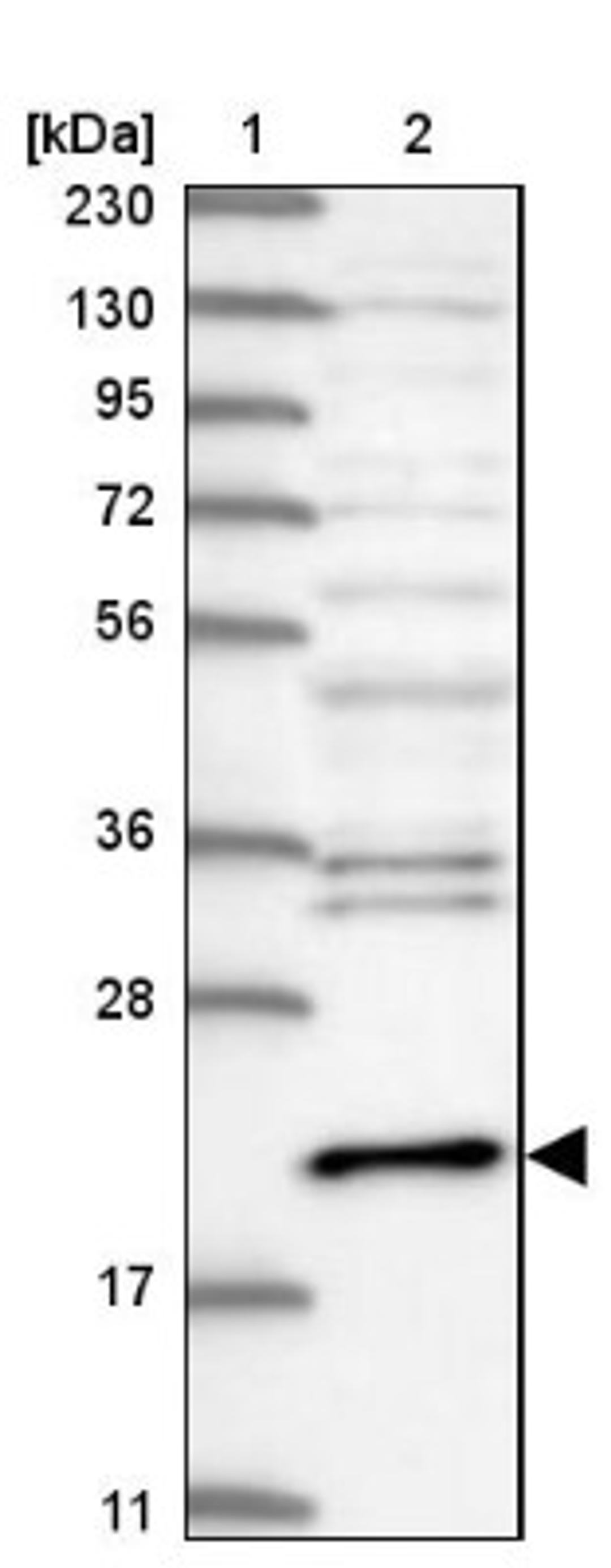 Western Blot: Centrin 3 Antibody [NBP1-84547] - Lane 1: Marker [kDa] 230, 130, 95, 72, 56, 36, 28, 17, 11<br/>Lane 2: Human cell line RT-4