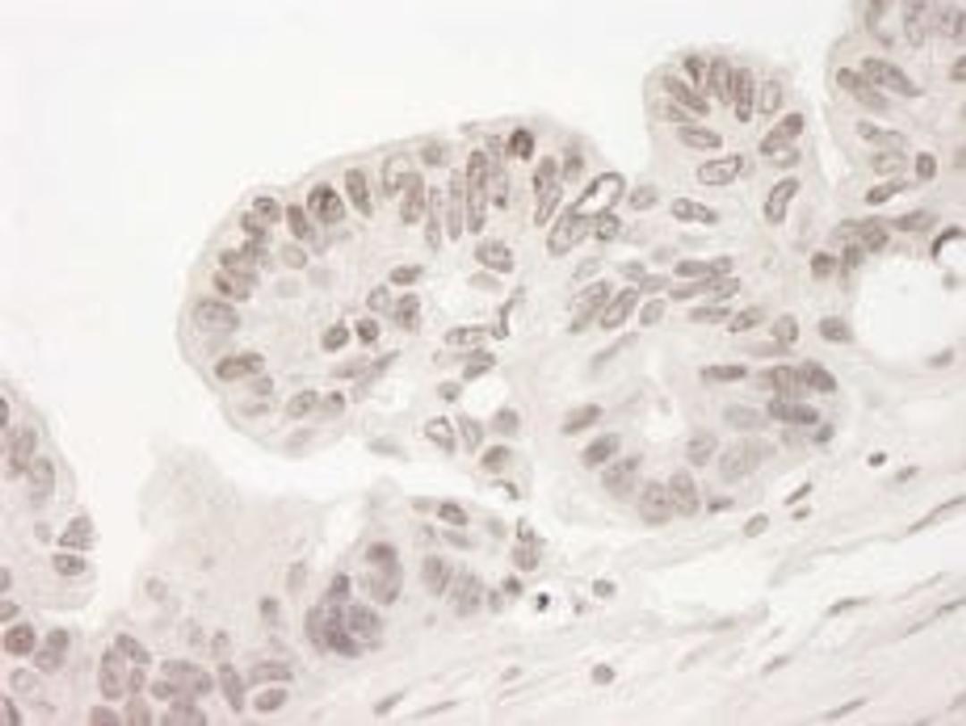 Detection of human TORC2 by immunohistochemistry.