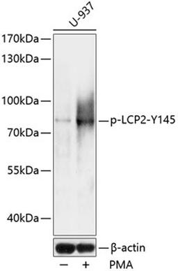 Western blot - Phospho-LCP2-Y145 antibody (AP0816)