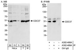 Detection of human and mouse CDC37 by western blot (h&m) and immunoprecipitation (h).