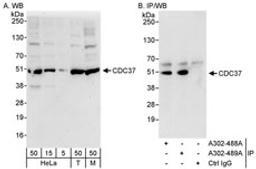 Detection of human and mouse CDC37 by western blot (h&m) and immunoprecipitation (h).