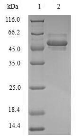 (Tris-Glycine gel) Discontinuous SDS-PAGE (reduced) with 5% enrichment gel and 15% separation gel.