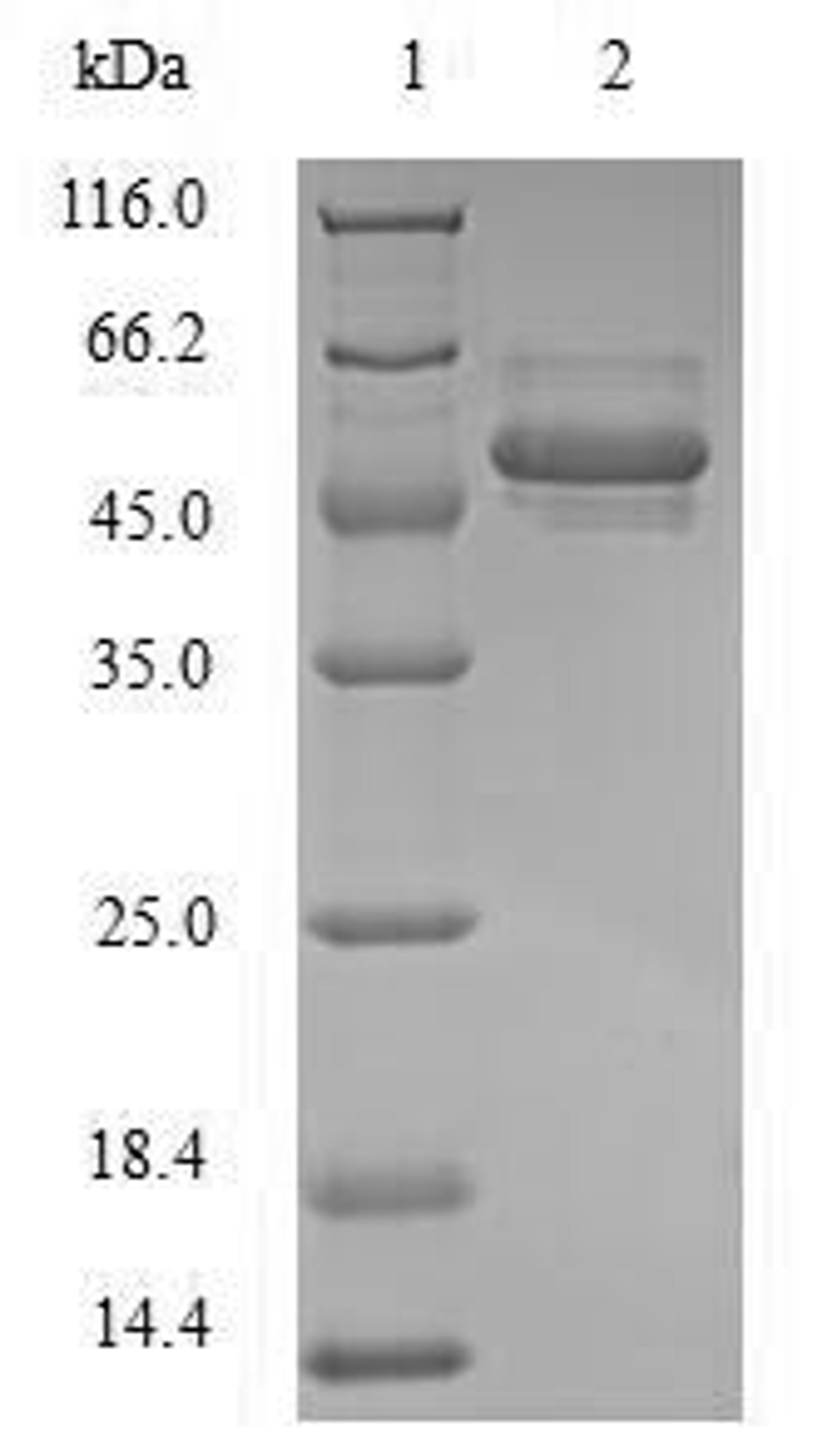 (Tris-Glycine gel) Discontinuous SDS-PAGE (reduced) with 5% enrichment gel and 15% separation gel.