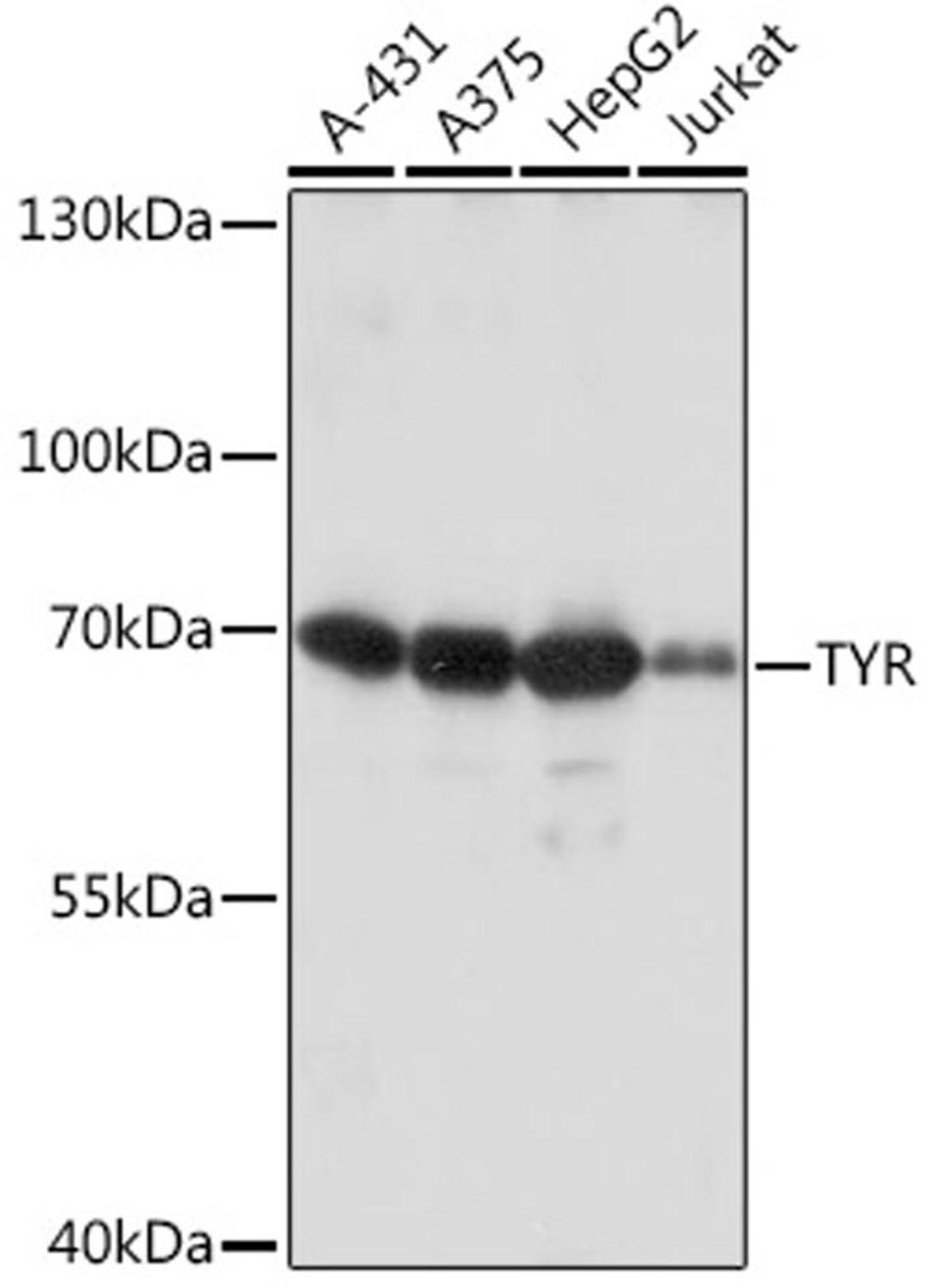 Western blot - TYR Rabbit pAb (A16993)