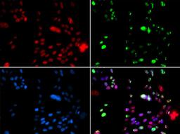 Immunofluorescence - PIAS1 antibody (A5729)