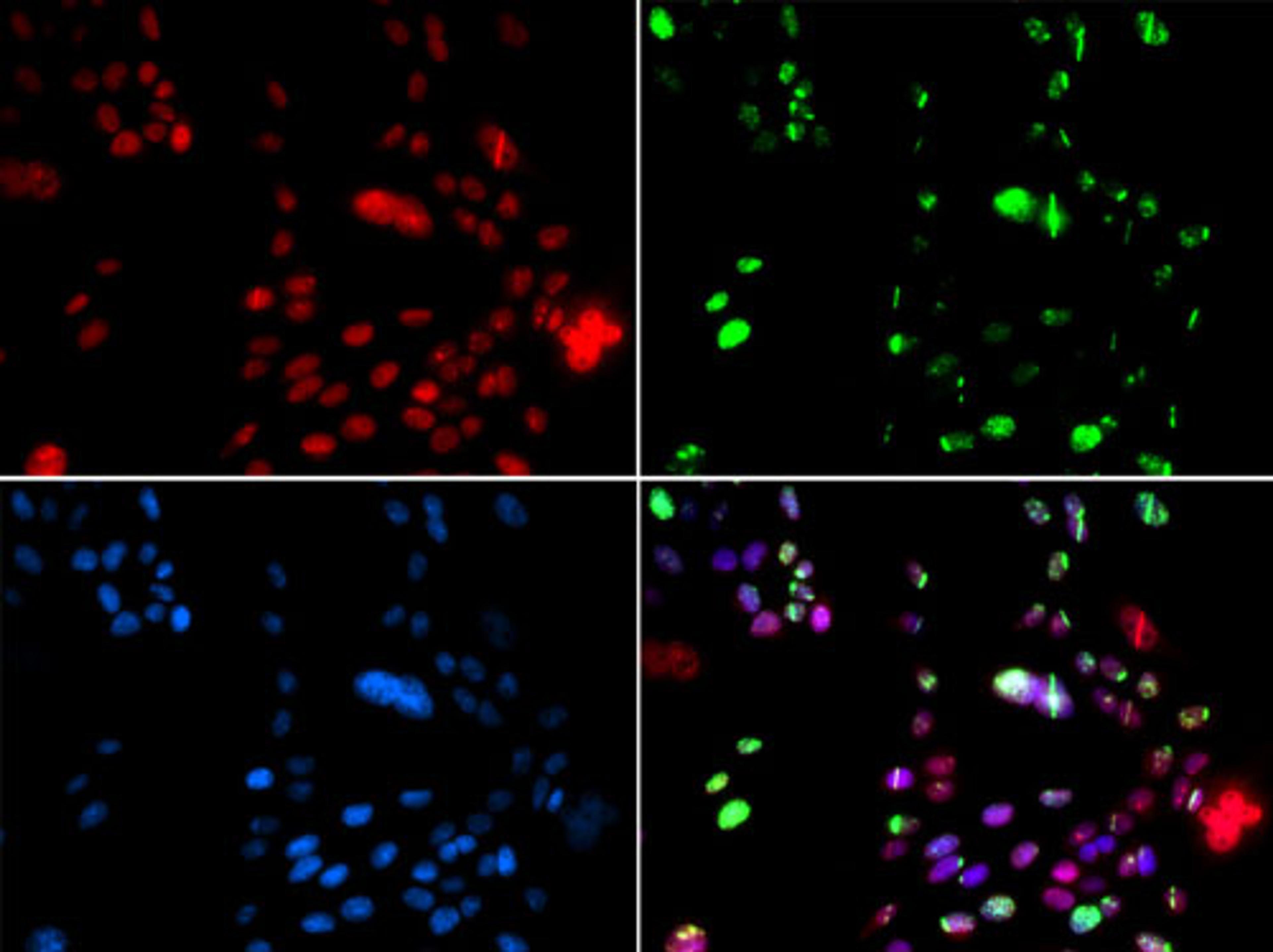 Immunofluorescence - PIAS1 antibody (A5729)