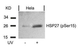 Western blot analysis of extracts from Hela cells untreated or treated with UV using HSP27(Phospho-Ser15) Antibody.