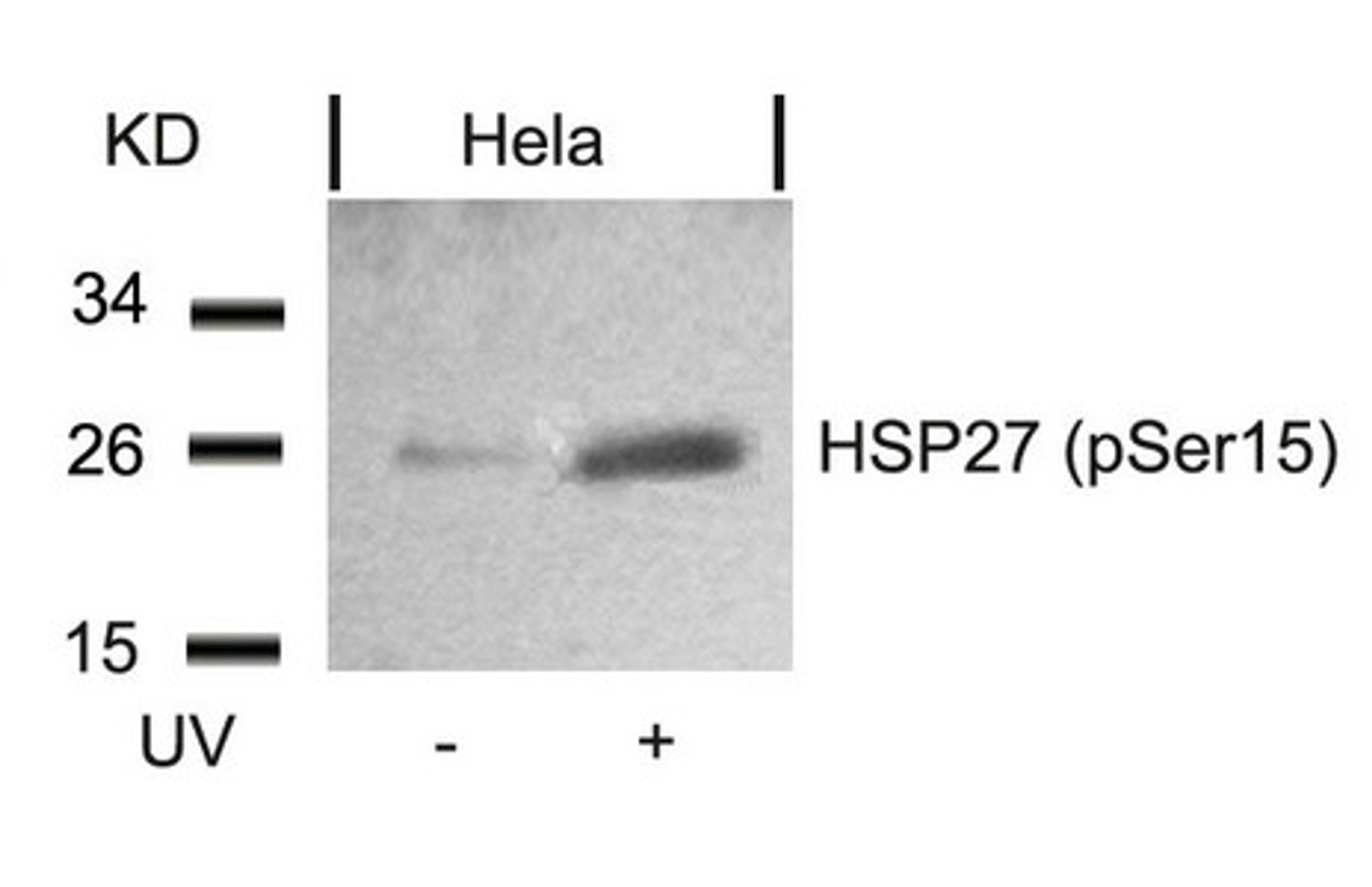 Western blot analysis of extracts from Hela cells untreated or treated with UV using HSP27(Phospho-Ser15) Antibody.