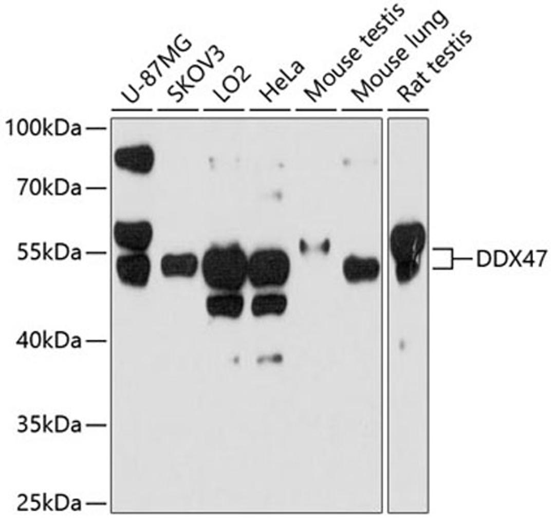 Western blot - DDX47 antibody (A10359)