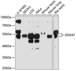 Western blot - DDX47 antibody (A10359)