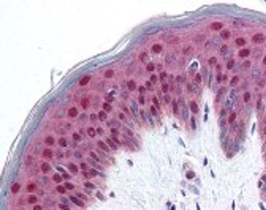 Immunohistochemistry staining of PDCD4 in skin, human tissue using PDCD4 Antibody.